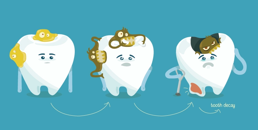 أسباب تسوس الأسنان رغم تنظيفها | البكتيريا المسببة للتسوس