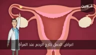 هذه كل اعراض الحمل خارج الرحم عند المرأة