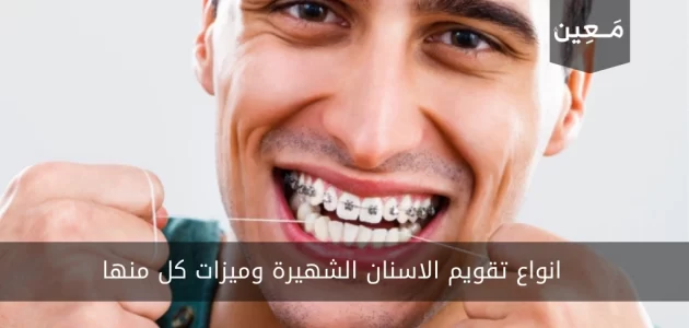انواع تقويم الاسنان الشهيرة ومواصفاتها