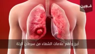 أبرز وأهم علامات الشفاء من سرطان الرئة