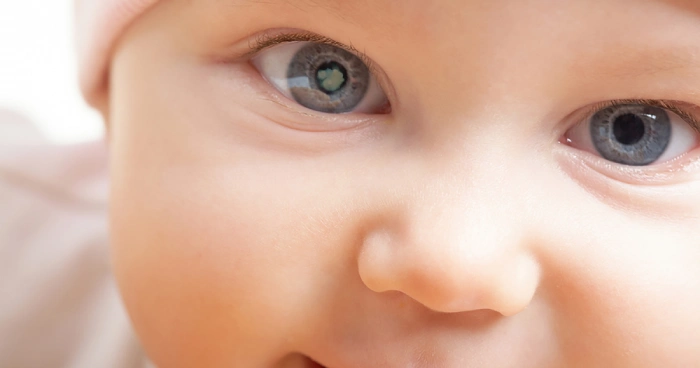 اعراض الماء الابيض في العين للأطفال