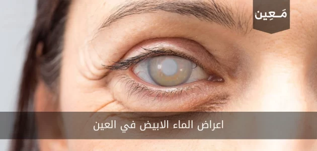 اعراض الماء الابيض في العين | هل تتشابه الاعراض بين الكبار و الاطفال