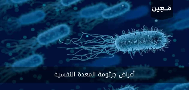 أعراض جرثومة المعدة النفسية | ماهي أهمها وطريقة العلاج الصحيحة