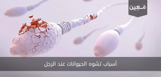 أسباب تشوه الحيوانات المنوية عند الرجل مع طرق وقاية لمنع التشوه