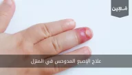 علاج الإصبع المدوحس في المنزل بطرق مجربة